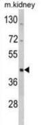 WD Repeat And SOCS Box Containing 2 antibody, abx033017, Abbexa, Western Blot image 