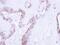 LIM Domain Kinase 2 antibody, PA5-21871, Invitrogen Antibodies, Immunohistochemistry frozen image 