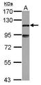 Microtubule Associated Protein 7 antibody, GTX120907, GeneTex, Western Blot image 