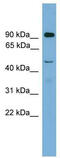 Zinc finger Y-chromosomal protein 2 antibody, TA341831, Origene, Western Blot image 