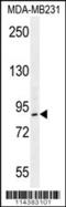 Lysine Acetyltransferase 2B antibody, 56-212, ProSci, Western Blot image 