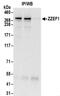 Zinc Finger ZZ-Type And EF-Hand Domain Containing 1 antibody, NBP2-32119, Novus Biologicals, Immunoprecipitation image 