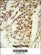 Centromere Protein H antibody, 63-840, ProSci, Immunohistochemistry paraffin image 