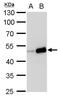 TIMELESS-interacting protein antibody, PA5-35995, Invitrogen Antibodies, Western Blot image 