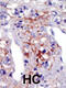 Phosphatidylinositol-4-Phosphate 5-Kinase Type 1 Gamma antibody, 63-358, ProSci, Immunohistochemistry paraffin image 
