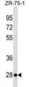 Killer Cell Lectin Like Receptor F2 antibody, abx030561, Abbexa, Western Blot image 