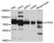 CTP Synthase 1 antibody, A3817, ABclonal Technology, Western Blot image 