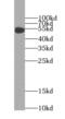 Fc Fragment Of IgE Receptor Ia antibody, FNab03058, FineTest, Western Blot image 
