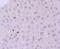 MutS Homolog 6 antibody, NBP2-66959, Novus Biologicals, Immunohistochemistry paraffin image 