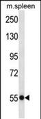 Ubiquitin-specific-processing protease 40 antibody, PA5-48596, Invitrogen Antibodies, Western Blot image 