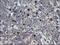 Migration And Invasion Enhancer 1 antibody, M07379-1, Boster Biological Technology, Immunohistochemistry paraffin image 