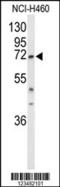 DEAD-Box Helicase 17 antibody, 63-895, ProSci, Western Blot image 