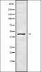 Testis Specific Serine Kinase 1B antibody, orb336329, Biorbyt, Western Blot image 