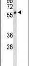 Plasmalemma Vesicle Associated Protein antibody, PA5-26384, Invitrogen Antibodies, Western Blot image 