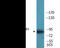 Ribosomal Protein S6 Kinase A5 antibody, EKC2572, Boster Biological Technology, Western Blot image 