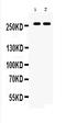 ATP Binding Cassette Subfamily A Member 4 antibody, A01048, Boster Biological Technology, Western Blot image 