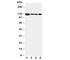 EPH Receptor A2 antibody, R30834, NSJ Bioreagents, Western Blot image 