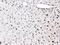 High Mobility Group Box 1 antibody, A00066-1, Boster Biological Technology, Immunohistochemistry frozen image 