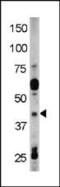 RAD9 Checkpoint Clamp Component A antibody, PA5-12676, Invitrogen Antibodies, Western Blot image 