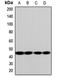Solute Carrier Family 7 Member 5 antibody, orb412136, Biorbyt, Western Blot image 