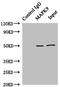 Mitogen-Activated Protein Kinase 9 antibody, A50362-100, Epigentek, Western Blot image 