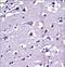 Matrix Metallopeptidase 16 antibody, LS-C164238, Lifespan Biosciences, Immunohistochemistry frozen image 