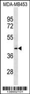 Mitochondrial Ribosomal Protein L46 antibody, 60-347, ProSci, Western Blot image 