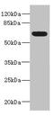 Activated Leukocyte Cell Adhesion Molecule antibody, LS-C675372, Lifespan Biosciences, Western Blot image 