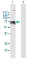 Lamin B Receptor antibody, H00003930-B01P, Novus Biologicals, Western Blot image 