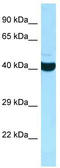 ADP-Ribosylhydrolase Like 2 antibody, TA331306, Origene, Western Blot image 