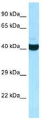 ADP-Ribosylhydrolase Like 2 antibody, TA331306, Origene, Western Blot image 