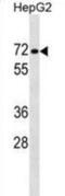 Protein Phosphatase 1 Regulatory Subunit 16B antibody, abx029640, Abbexa, Western Blot image 