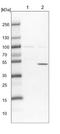Tetratricopeptide Repeat Domain 38 antibody, NBP1-82163, Novus Biologicals, Western Blot image 