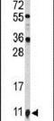 S100A10 antibody, PA5-26100, Invitrogen Antibodies, Western Blot image 