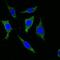 Keratin 5 antibody, MA5-15507, Invitrogen Antibodies, Immunofluorescence image 