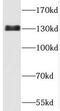 Tubulin Folding Cofactor D antibody, FNab08519, FineTest, Western Blot image 