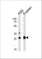 Solute Carrier Family 25 Member 37 antibody, A10701, Boster Biological Technology, Western Blot image 