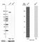 Collagen Type XVII Alpha 1 Chain antibody, NBP1-91800, Novus Biologicals, Western Blot image 