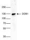 Damage Specific DNA Binding Protein 1 antibody, NBP2-62791, Novus Biologicals, Western Blot image 