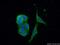 Codanin-1 antibody, 17597-1-AP, Proteintech Group, Immunofluorescence image 