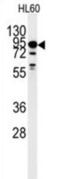 Dual Specificity Tyrosine Phosphorylation Regulated Kinase 1A antibody, abx033473, Abbexa, Western Blot image 