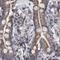 Dihydrolipoamide Branched Chain Transacylase E2 antibody, NBP1-89522, Novus Biologicals, Immunohistochemistry paraffin image 