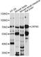 Leucine Rich Repeat And Fibronectin Type III Domain Containing 3 antibody, LS-C749907, Lifespan Biosciences, Western Blot image 