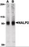 Nibrin antibody, orb86727, Biorbyt, Western Blot image 