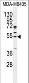 Cycb antibody, LS-C168462, Lifespan Biosciences, Western Blot image 