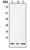 Insulin antibody, LS-C353787, Lifespan Biosciences, Western Blot image 