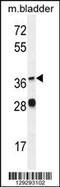 Fatty Acid Desaturase 6 antibody, 55-872, ProSci, Western Blot image 