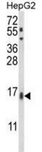 Microsomal Glutathione S-Transferase 2 antibody, GTX80967, GeneTex, Western Blot image 