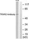 Thioredoxin Reductase 2 antibody, TA311671, Origene, Western Blot image 