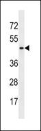 Armadillo Repeat Containing X-Linked 4 antibody, LS-C203722, Lifespan Biosciences, Western Blot image 